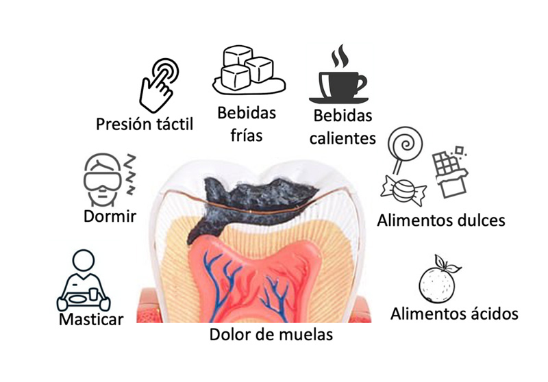 Caries dental